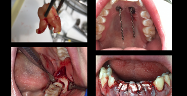 Advanced Surgical Mentorship